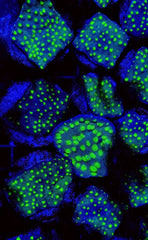 Echinopora spp. (Premium) (frag)